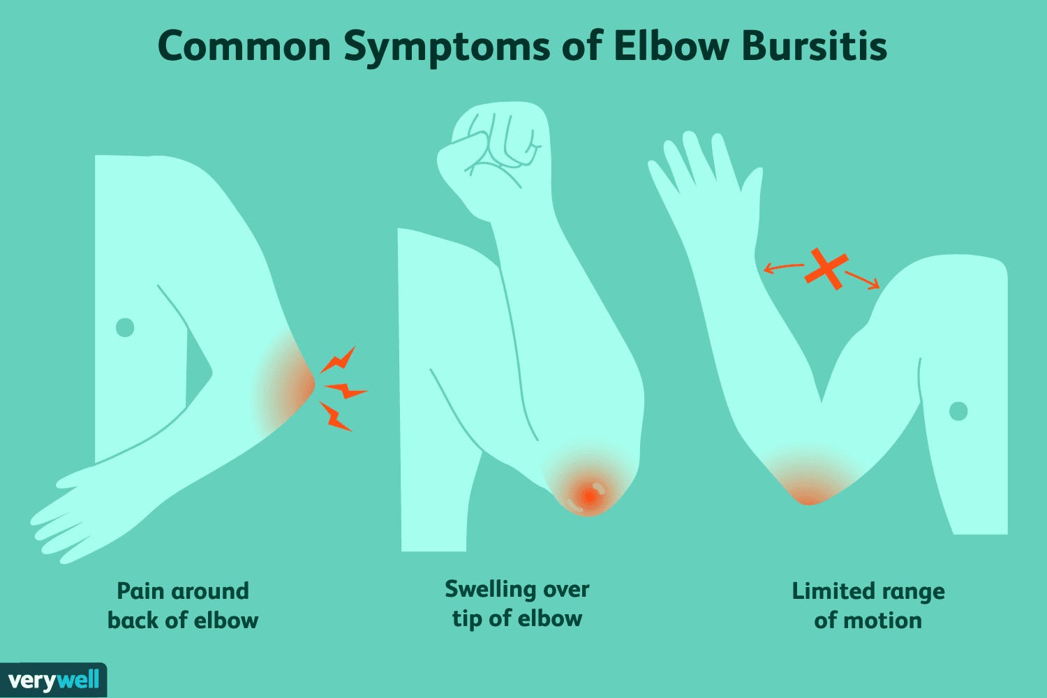 Balance training for older adults