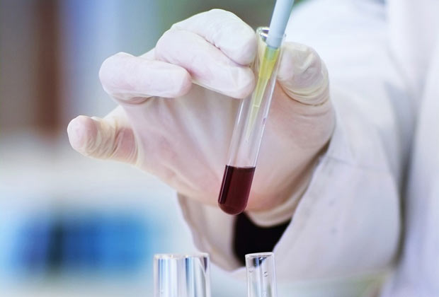 Hamstring strain recovery phases